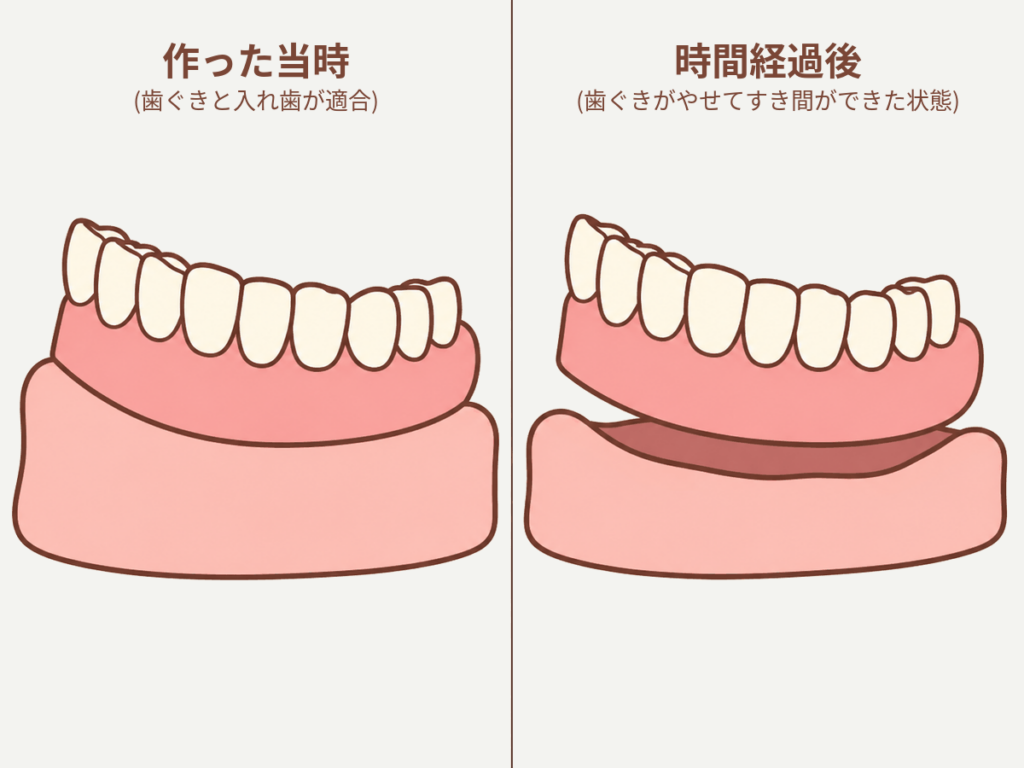 入れ歯が合わない・痛くなる主な原因