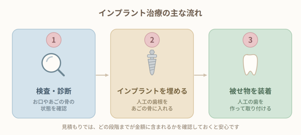 インプラント治療の主な流れ
