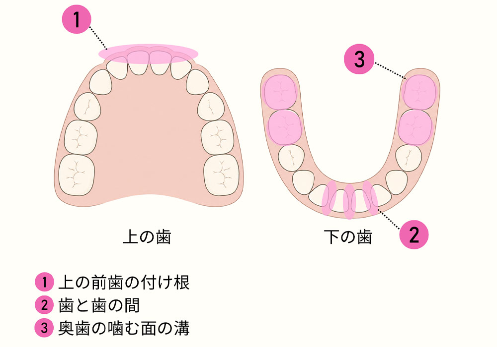 家庭での仕上げ磨きは、続けやすさを優先する