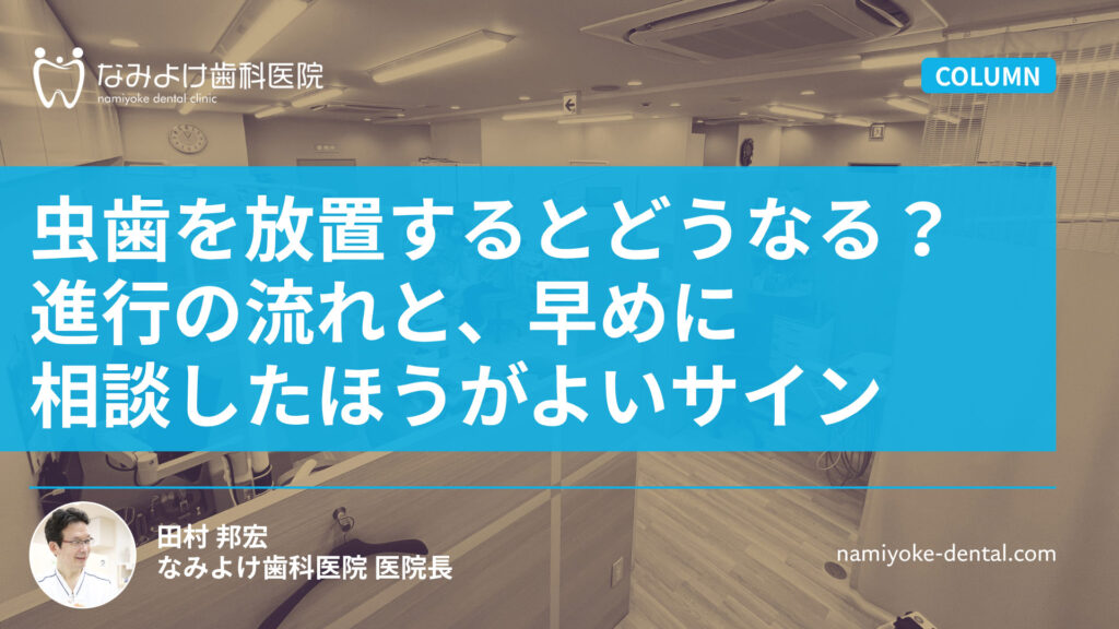 虫歯を放置するとどうなる？進行の流れと、早めに相談したほうがよいサイン
