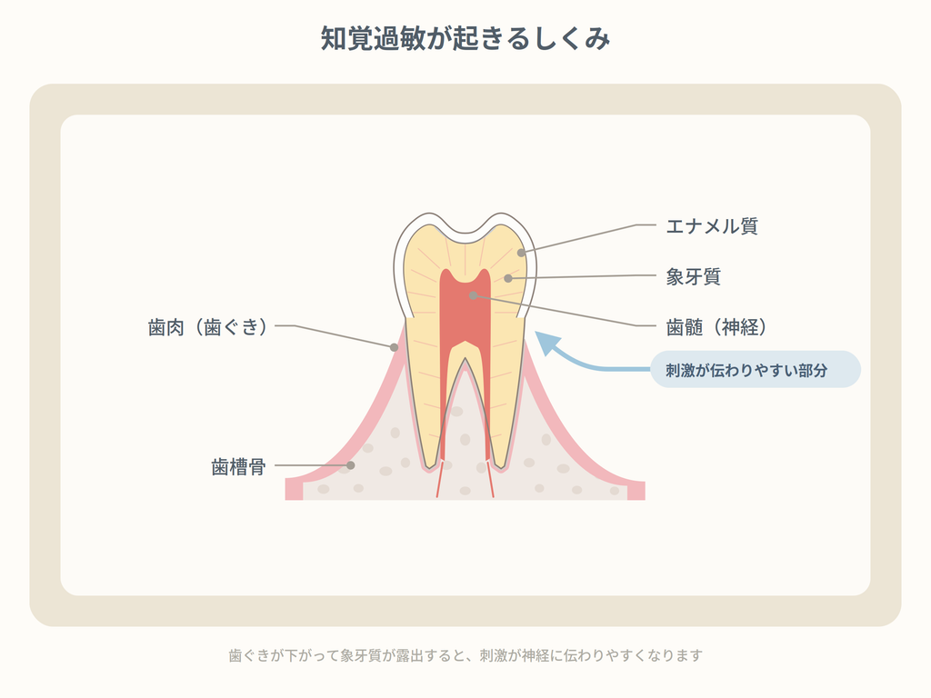 そもそも知覚過敏はどうして起きるのか