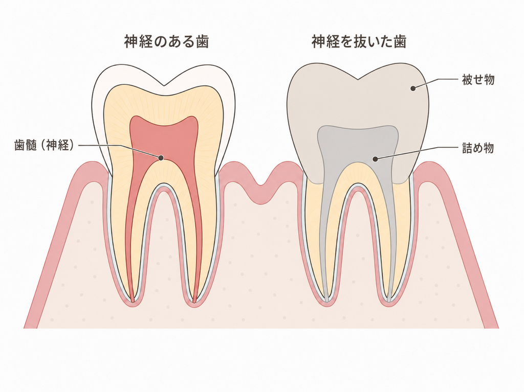 歯の神経を抜くことで起こりやすいデメリット